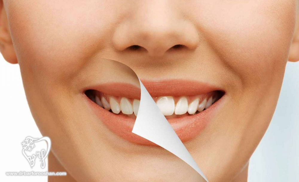 دندانپزشکی زیبایی