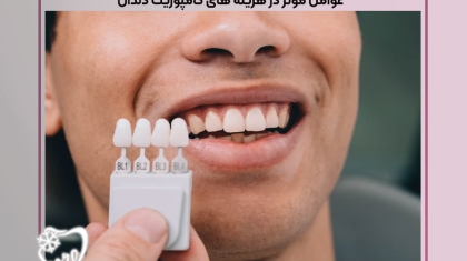 هزینه های کامپوزیت دندان