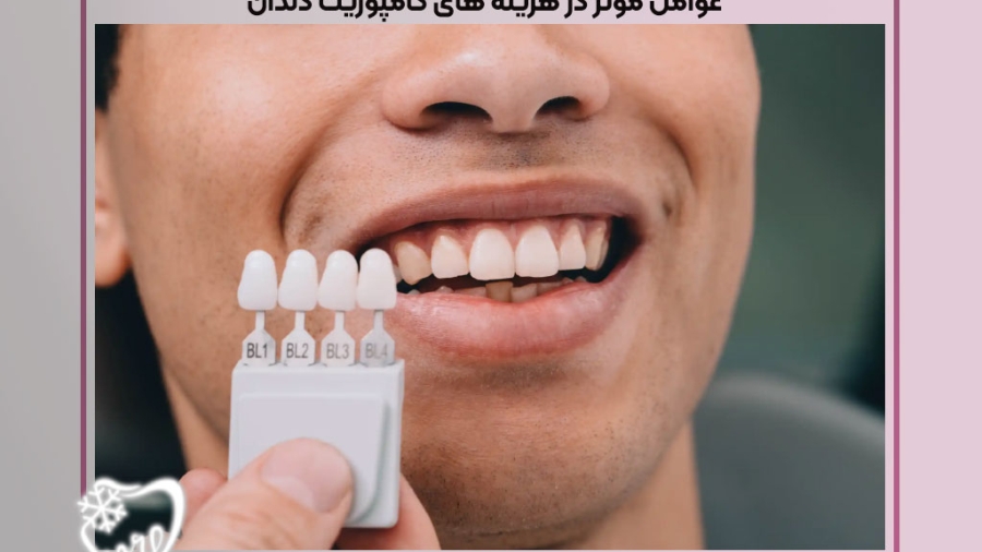 هزینه های کامپوزیت دندان