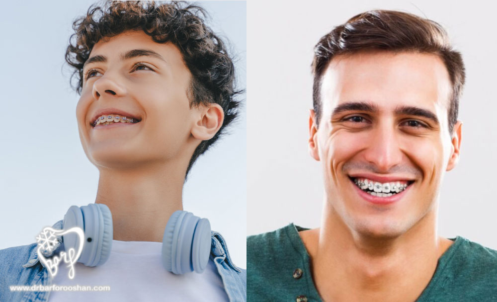 بهترین زمان برای ارتودنسی