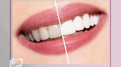 دندانپزشکی زیبایی در امام خمینی