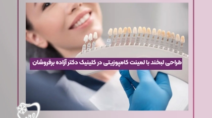 طراحی لبخند با لمینت کامپوزیتی