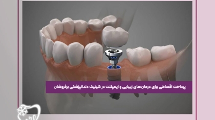 درمان های زیبایی و ایمپلنت