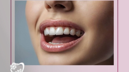 آیا لمینت دندان به دندان طبیعی آسیب میزند