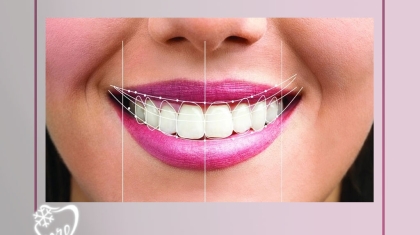جراحی لثه و طراحی لبخند در خیابان امام خمینی