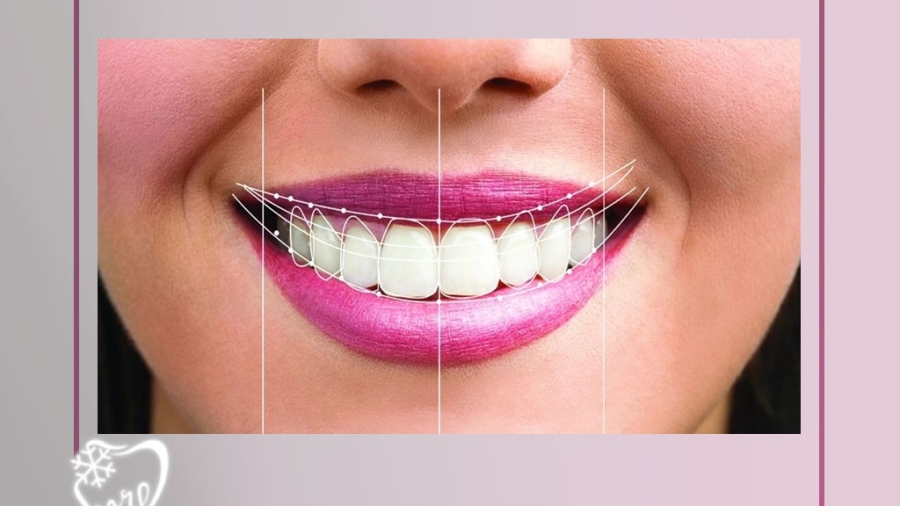 جراحی لثه و طراحی لبخند در خیابان امام خمینی